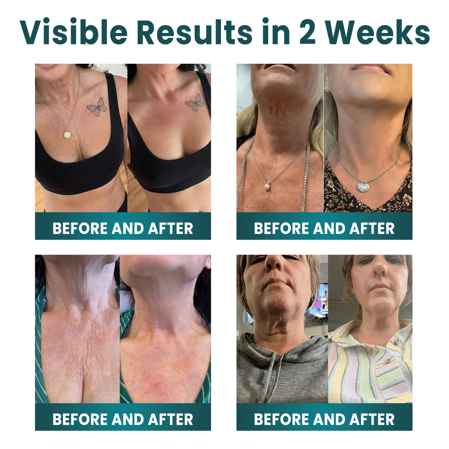 ✨ NORUION®  Q10 x Botanical Nano Exosome Advanced Anti-Wrinkle Cream