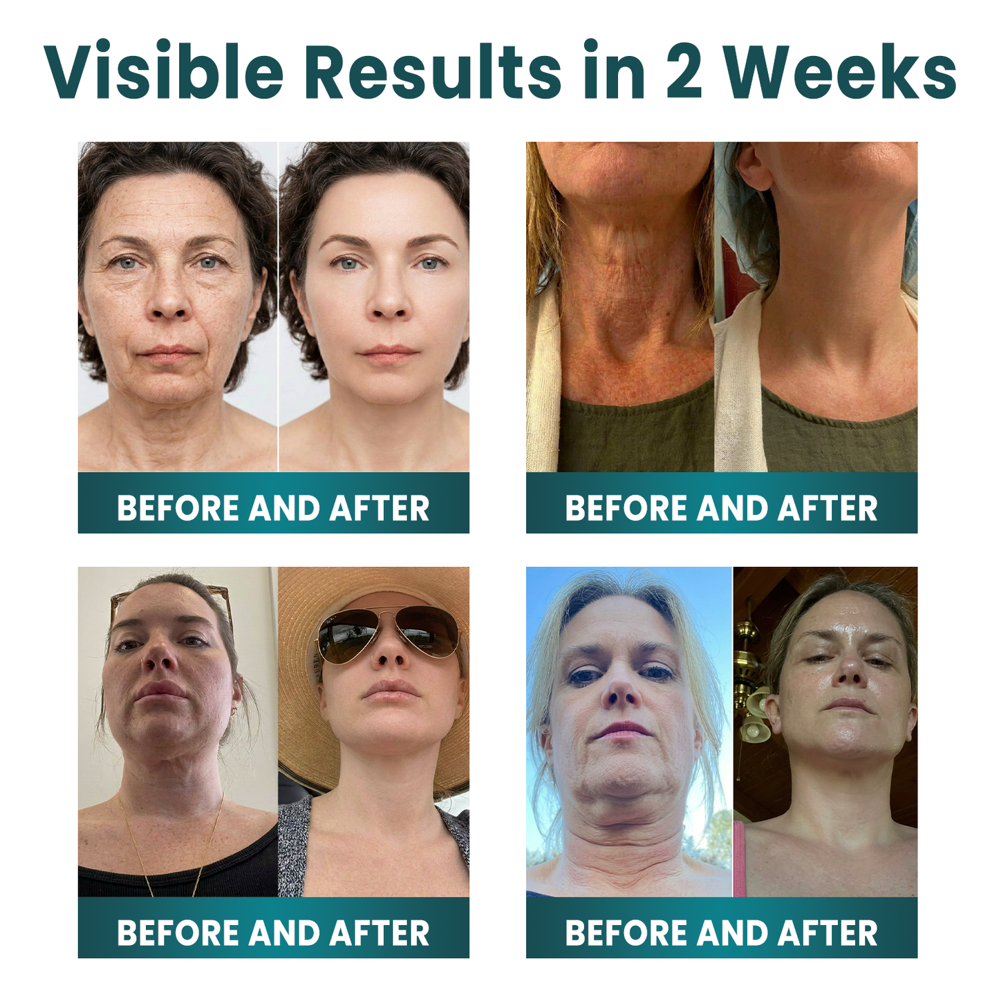✨ NORUION®  Q10 x Botanical Nano Exosome Advanced Anti-Wrinkle Cream