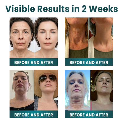 ✨ NORUION®  Q10 x Botanical Nano Exosome Advanced Anti-Wrinkle Cream