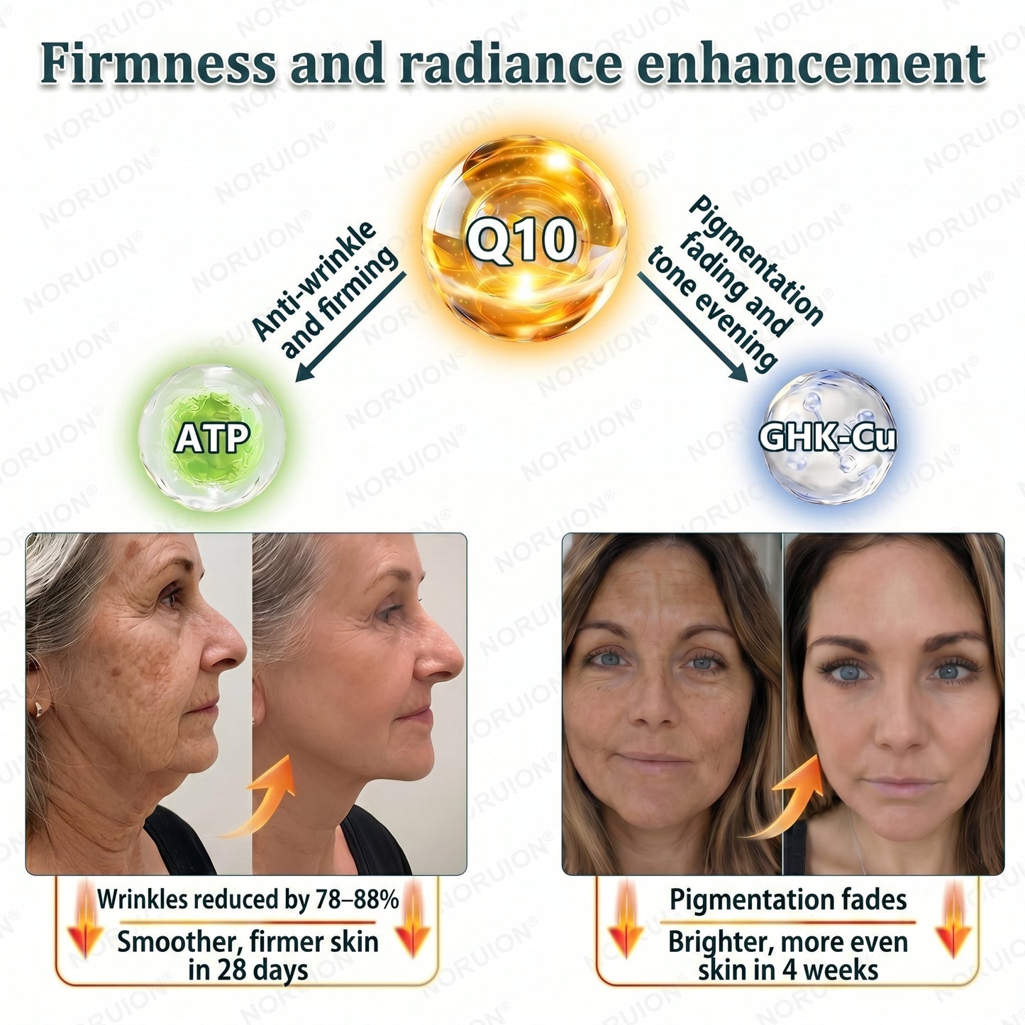 🇺🇸 NORUION®  Q10 x Botanical Nano Exosome Advanced Anti-Wrinkle Cream