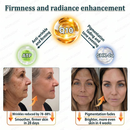 🇺🇸 NORUION®  Q10 x Botanical Nano Exosome Advanced Anti-Wrinkle Cream