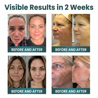 🇺🇸 NORUION®  Q10 x Botanical Nano Exosome Advanced Anti-Wrinkle Cream
